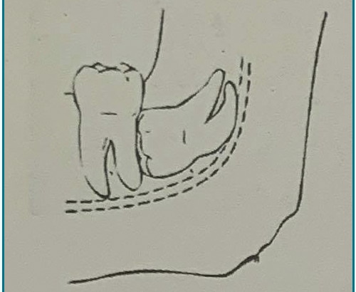 Cirurgia Bucal